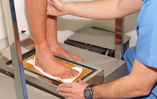 La-importancia-del-calzado-Estudio-biomecánico-de-la-pisada-4 La-importancia-del-calzado-Estudio-biomecánico-de-la-pisada Podologia Deportiva