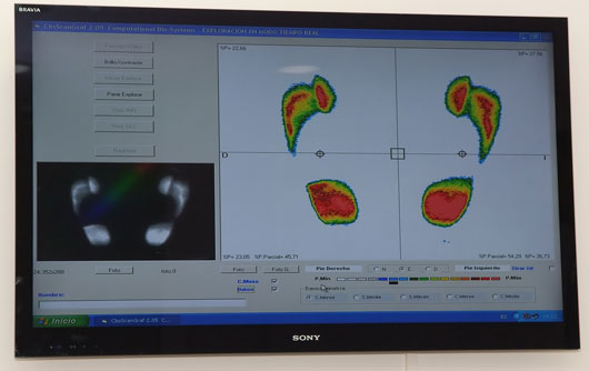 La-importancia-del-calzado-Estudio-biomecánico-de-la-pisada-6 La-importancia-del-calzado-Estudio-biomecánico-de-la-pisada Podologia Deportiva