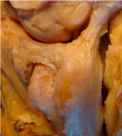 Ligamentos radiocubitales