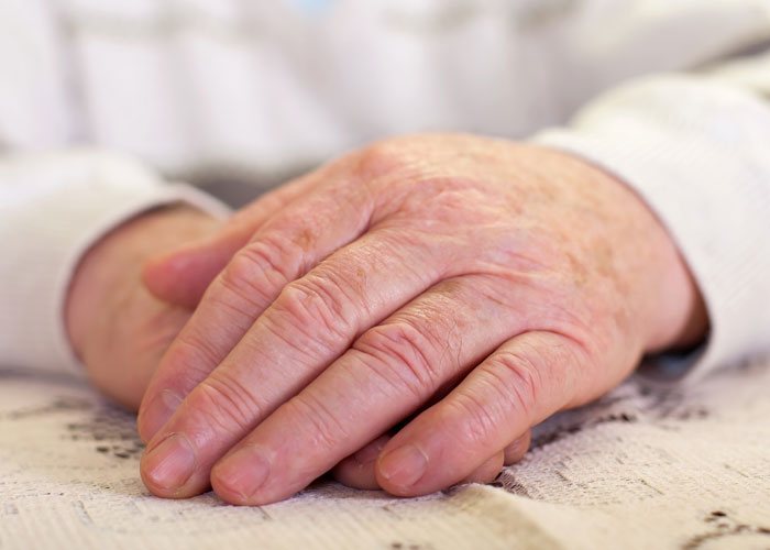 Los síntomas de la mano degenerativa varían según la patología y el grado de evolución, pero los más habituales son: dolor, rigidez, pérdida de fuerza, hinchazón, sensibilidad, deformidades, limitación funcional