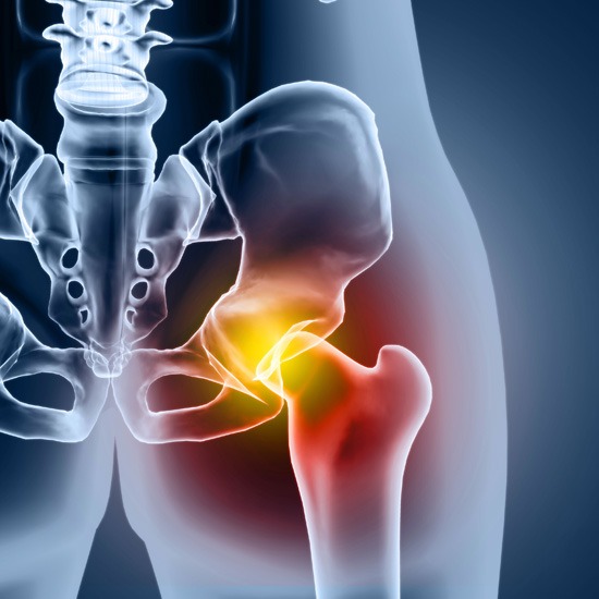 Valoración especializada de dolor o complicaciones después de una prótesis de cadera